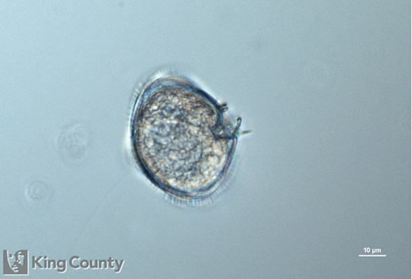 Photo of Protoperidinium pellucidum/Protoperidinium steinii